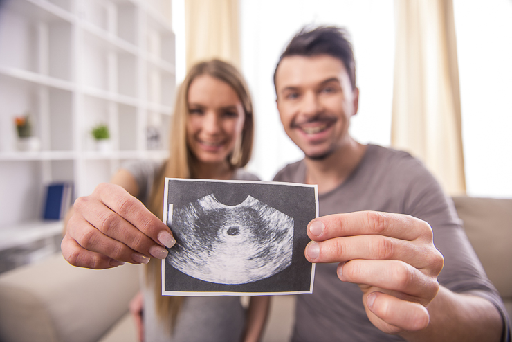 Happy,Couple,Are,Holding,Ultrasound,Scan,Of,Their,Baby.